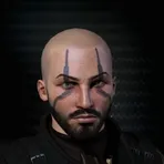 Alex Laser